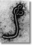 Ebola